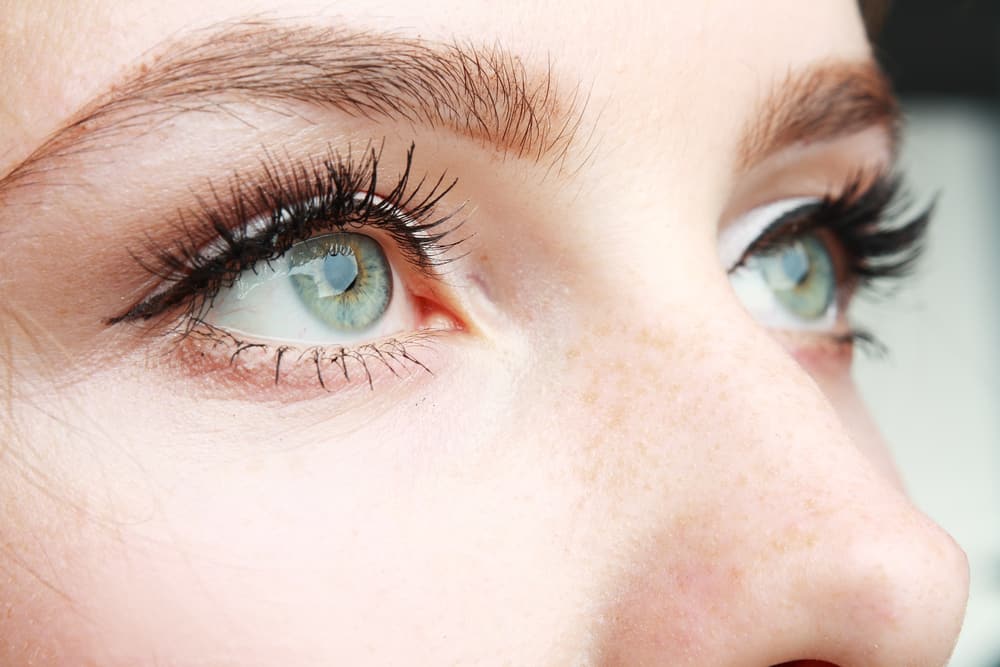 How to Improve Droopy Upper Eyelids