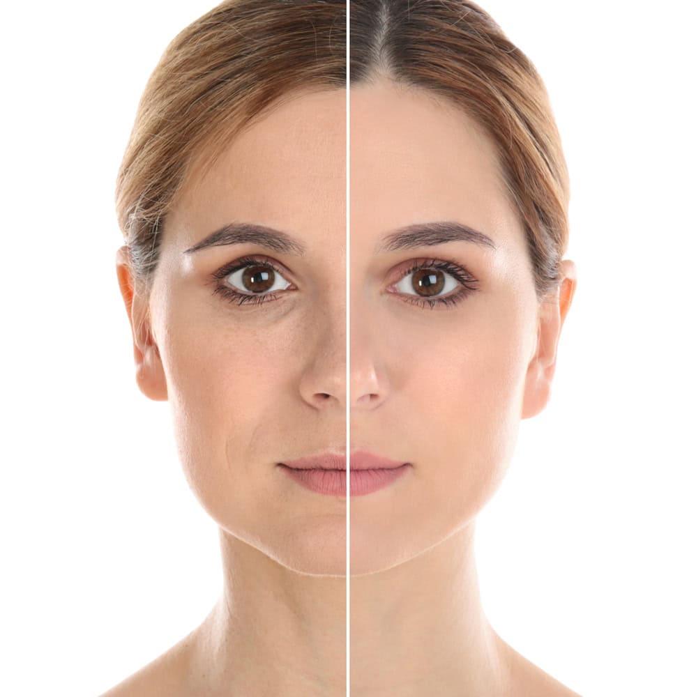 How Eyelid Surgery Can Refresh Your Appearance