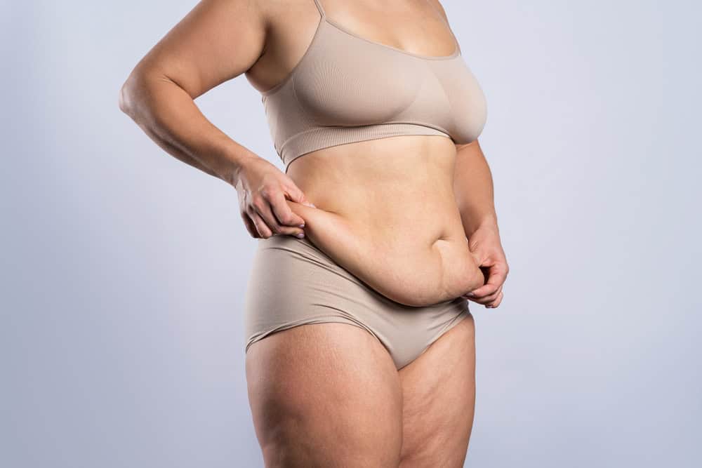 Can I Combine Liposuction with Another Body Contouring Procedure?