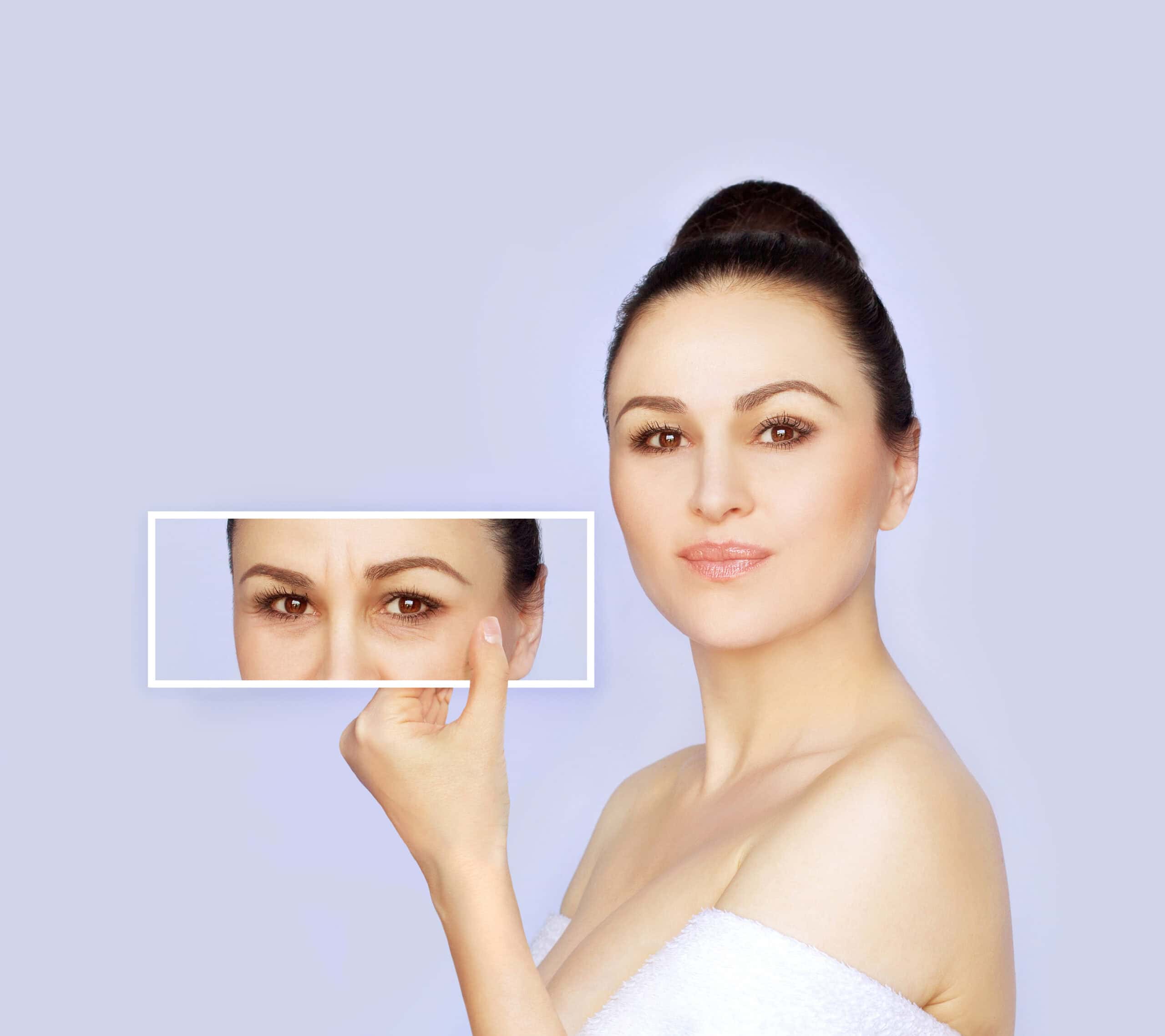 Can You Have Upper and Lower Eyelid Surgery Together?