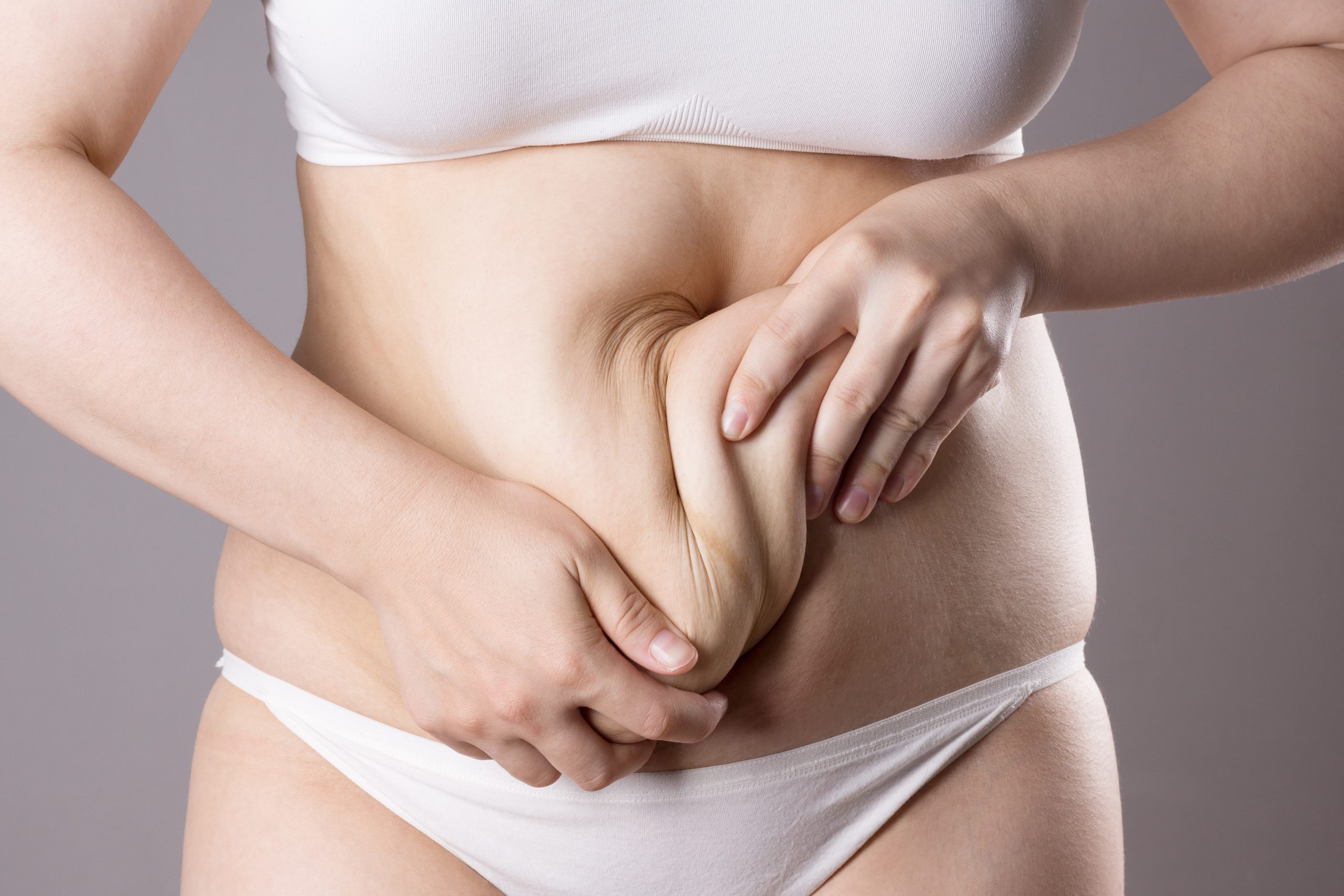 How to Minimize Scars After a Tummy Tuck